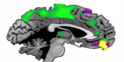 ventro orta prefrontal korteks (sarı bölge) diğer insanlara daha fazla güvenen insanlarda, diğer insanlara daha az güvenen insanlardakine kıyasla daha büyüktür.
