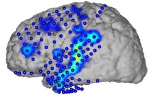 Elektrokortikografi ile kaydedilen beyin aktivitesi (mavi noktalar). Aktivite örüntülerinden (mavi/sarı) konuşulan sözcükler tanınabiliyor. Fotoğraf: CSL/KIT