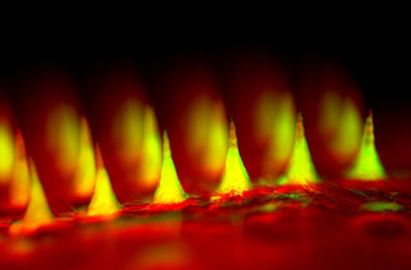 Figür 2 : İnsülinlerin yeşil renk ile işaretlendiği mikroiğnelerin yakın çekim flüoresan görüntüsü. Görsel : Zhen Gu, PhD