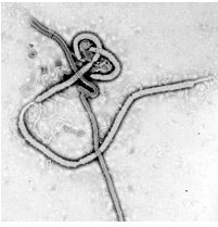 Elektron mikroskobu altında Ebola virüsü görüntüsü