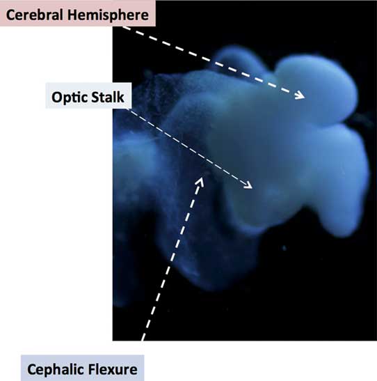 Üretilen organcıktaki beyin yarıküresi, optik sap ve sefalik büklüm. (Telif: The Ohio State University)