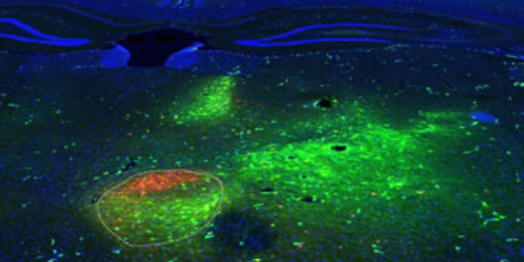 Sinirsel bağlantıları gözlemlemek için, kırmızı ve yeşil işaretleyiciler orbitofrontal korteks'in iki ayrı bölgesine uygulandı. Daha sonra mekanizma işleyişi süresince hareket eden bu bileşikler talamus'taki nöronlarda birikti. İki işaretleyici ile yüksek yoğunlukla boyanan submedius thalamic nucleus bölgesi görselde rahatlıkla görülebiliyor (kesik çizgi ile işaretlenen alan). Telif : Bordeaux Imaging Centre / Fabien Alcaraz
