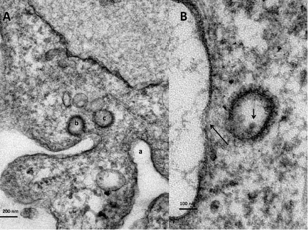 Sol: Endozomlar (b,c) Sağ: Ok endozom içindeki virüs partikülünü gösteriyor. (Telif:F. Brent Johnson and Enkhmart Dudleenamjil 2012 DOI: 10.5772/48510)