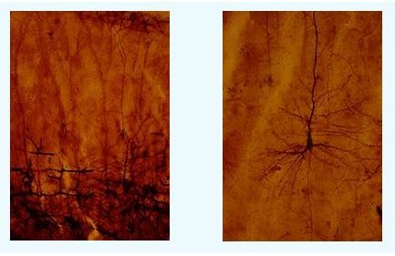 Fotoğraf : Cajal’ın hazırladığı ve bugün Madrid’deki Cajal Enstitüsü’nde bulunan Cajal Müzesi’nde sergilenmekte olan, yeni doğan nöronlarının Golgi metodu ile boyanmış fotomikrograf görüntüleri. 