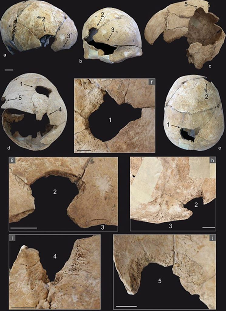 yarali-kemikler-neolitik-savasa-isaret-ediyor1-bilimfilicom