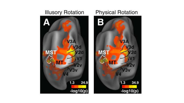YANXIA PAN ET AL., 2016, REPRESENTATION OF ILLUSORY AND PHYSICAL ROTATIONS IN HUMAN MST, HUMAN BRAIN MAPPING Â© 2016 WILEY PERIODICALS, INC. ALL RIGHTS RESERVED
