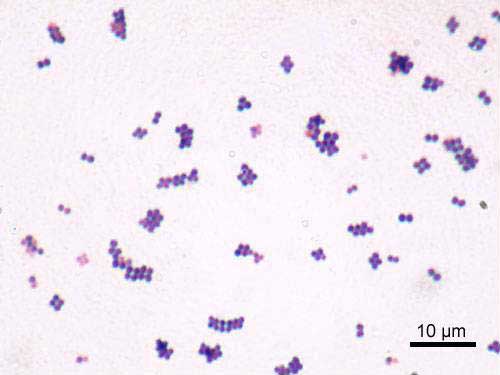 Gram (kristal viyole) boyama ile sevimli bir mor renk alan, üzüm salkımları şeklinde kümelenen ve katliam için zayıf an kollayan bakteri: S.aureus