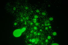 Petrol yiyen bakterinin mikroskop görüntüsü / Tony Gutierrez, Heriot-Watt University