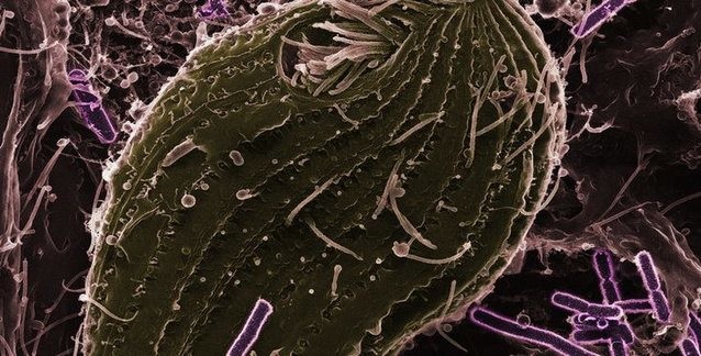 Post Cover Image