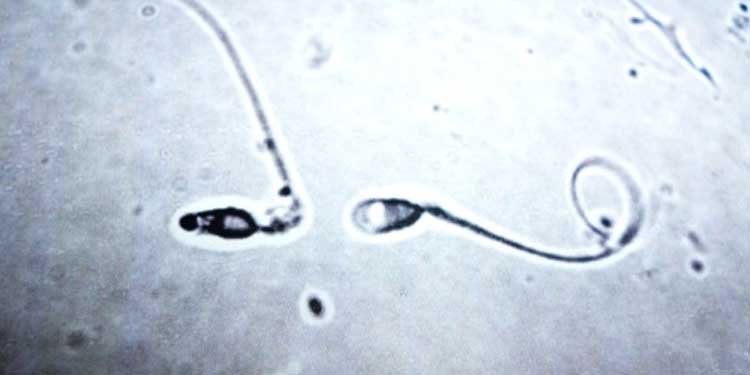 Laboratuvarda İlk Kez Sperm Üretildi