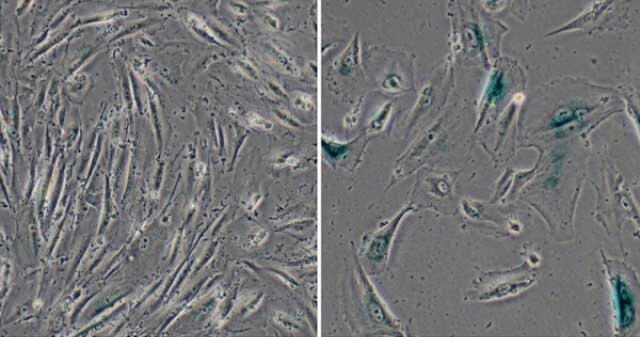 Görsel : Salk Institute , This image shows normal human cells (left) and genetically modified cells developed by the Salk scientists to simulate Werner syndrome (right), which showed signs of aging, including their larger size 