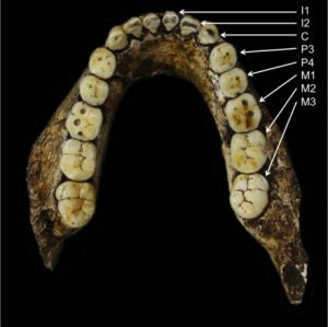 İlkel atalarımız çok farklı dişlere sahiptiler. Homo cinsinin ilk halleri ilkel Afrikalı atalarımız çenenin arka kısmına doğru giderek büyüyen azı dişlerine sahiptiler. Homo cinsinde ise, bu örgü değişti, böylelikle çenenin her iki tarafındaki dişler küçülürken ilk azı dişi (M1) en büyük diş oldu. Fotoğrafta, P3 ve P4; dişleri küçük azıları, C; köpek dişini ve M ise azı dişlerini gösteriyor. (Credit: lawnchairanthropology) -bilimfili.com